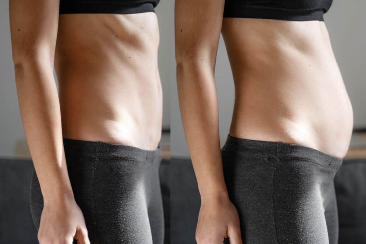How long does diastasis recti take to improve Northwood?